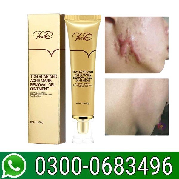 Akary Acne Scar Removal Cream In Pakistan