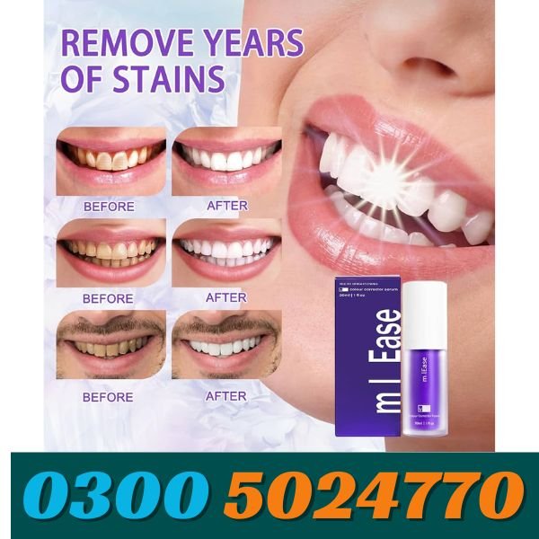 Mint Teeth Whitening Mousse In Pakistan