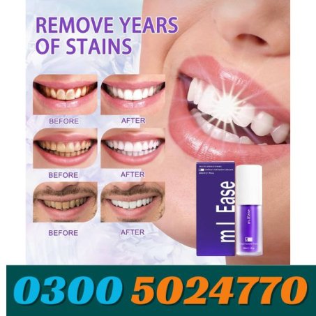 Mint Teeth Whitening Mousse In Pakistan