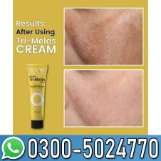  Melas Night Cream For Men & Women In Pakistan